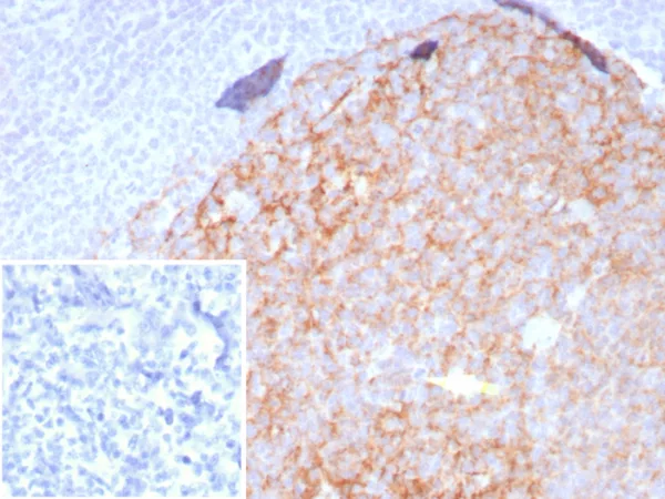 Formalin-fixed, paraffin-embedded human tonsil stained with CD23 Recombinant Rabbit Monoclonal Antibody (FCER2/8509R). Inset: PBS instead of primary antibody; secondary only negative control.