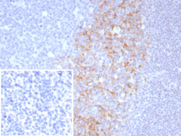 Formalin-fixed, paraffin-embedded human tonsil stained with CD23 Recombinant Rabbit Monoclonal Antibody (FCER2/8511R). Inset: PBS instead of primary antibody; secondary only negative control.