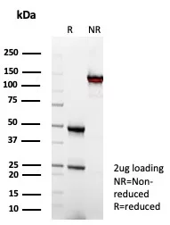 SDS-PAGE Analysis of Purified CD64 Mouse Monoclonal Antibody (FCGR1A/7497). Confirmation of Integrity and Purity of Antibody.