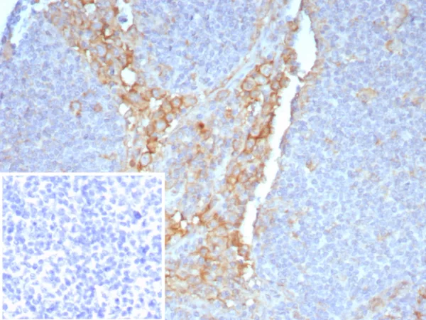 CD64 / Fc gamma RI Antibody - Image 2