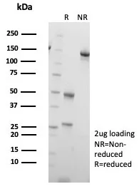 SDS-PAGE Analysis of Purified Fli1 Mouse Monoclonal Antibody (FLI1/7508). Confirmation of Purity and Integrity of Antibody.
