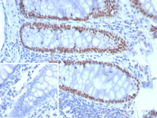 Recombinant SATB2 (Colorectal Carcinoma Marker) Antibody