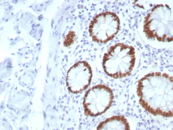 Formalin-fixed, paraffin-embedded human colon stained with SATB2 Rabbit Recombinant Monoclonal Antibody (SATB2/8877R). HIER: Tris/EDTA, pH9.0, 45min. 2°C: HRP-polymer, 30min. DAB, 5min.