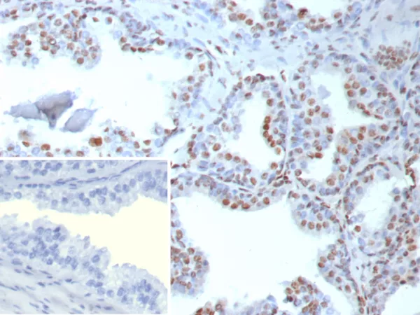 Recombinant TARDBP TAR DNA binding protein / TDP43 Antibody