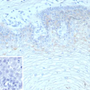 Formalin-fixed, paraffin-embedded human esophagus stained with TRIM29 Recombinant Rabbit Monoclonal Antibody (TRIM29/9257R). Inset: PBS instead of primary antibody; secondary only negative control.