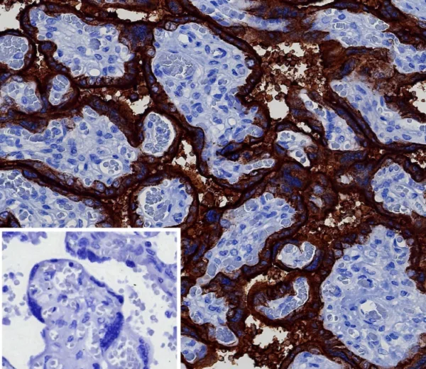 Formalin-fixed, paraffin-embedded human placenta stained with PLAP Rabbit Recombinant Monoclonal Antibody (ALPP/8112R). Inset: PBS instead of primary antibody; secondary only negative control.