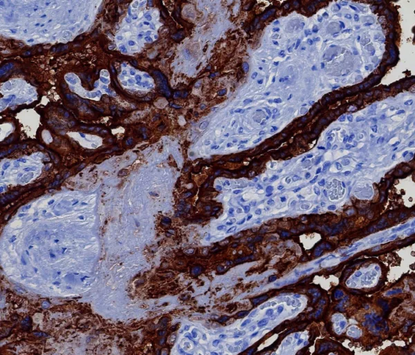 Formalin-fixed, paraffin-embedded human placenta stained with PLAP Rabbit Recombinant Monoclonal Antibody (ALPP/8112R). HIER: Tris/EDTA, pH9.0, 45min. 2°C: HRP-polymer, 30min. DAB, 5min.