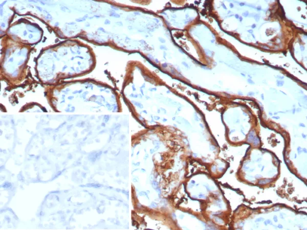 Formalin-fixed, paraffin-embedded human tonsil stained with PLAP Recombinant Rabbit Monoclonal Antibody (ALPP/9109R). Inset: PBS instead of primary antibody; secondary only negative control.