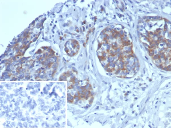 AMBP (Alpha 1 Microglobulin) / Bikunin Antibody