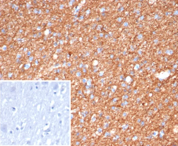 Formalin-fixed, paraffin-embedded human brain stained with GFAP Mouse Monoclonal Antibody (GFAP/6874). Inset: PBS instead of primary antibody; secondary only negative control.