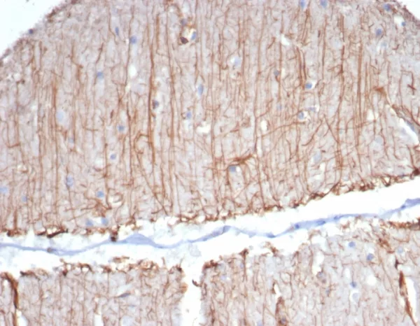 Formalin-fixed, paraffin-embedded human brain stained with GFAP Mouse Monoclonal Antibody (GFAP/6874). HIER: Tris/EDTA, pH9.0, 45min. 2°C: HRP-polymer, 30min. DAB, 5min.