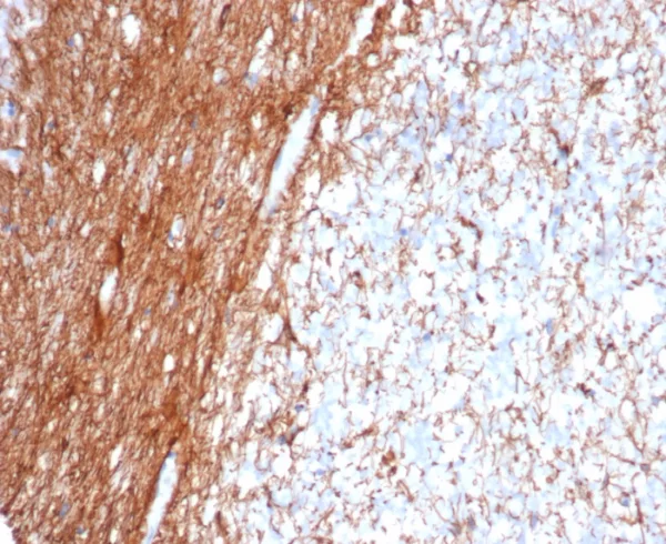 Formalin-fixed, paraffin-embedded human cerebellum stained with GFAP Mouse Monoclonal Antibody (GFAP/6876). HIER: Tris/EDTA, pH9.0, 45min. 2°C: HRP-polymer, 30min. DAB, 5min.