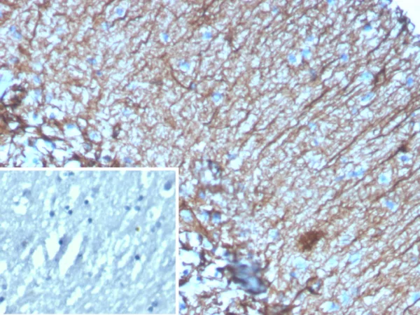 GFAP (Astrocyte & Neural Stem Cell Marker) Antibody