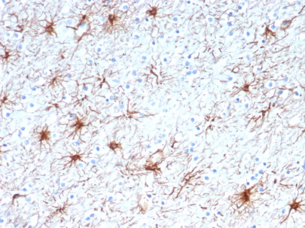 Formalin-fixed, paraffin-embedded human brain stained with GFAP Mouse Monoclonal Antibody (GFAP/6882). HIER: Tris/EDTA, pH9.0, 45min. 2°C: HRP-polymer, 30min. DAB, 5min.