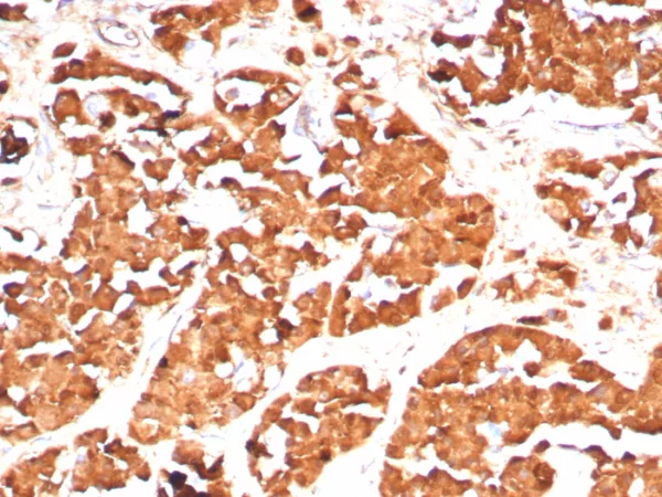 Formalin-fixed, paraffin-embedded human pituitary stained with Growth Hormone Recombinant Rabbit Monoclonal Antibody (GH/8136R). HIER: Tris/EDTA, pH9.0, 45min. 2: HRP-polymer, 30min. DAB, 5min.