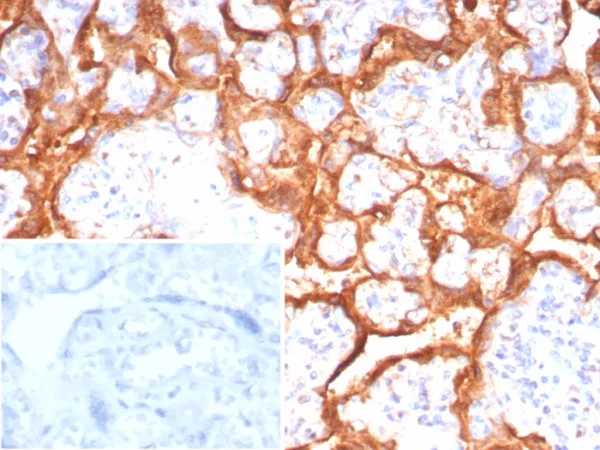 Formalin-fixed, paraffin-embedded human placenta stained with Growth Hormone Recombinant Rabbit Monoclonal Antibody (GH/8215R). Inset: PBS instead of primary antibody; secondary only negative control.
