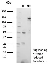 SDS-PAGE Analysis of Purified CD57 Mouse Monoclonal Antibody (NK1/7566). Confirmation of Purity and Integrity of Antibody.
