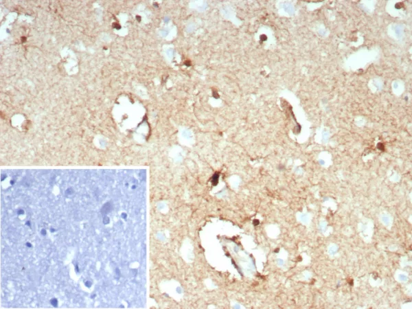 Formalin-fixed, paraffin-embedded human brain stained with GLUL Recombinant Rabbit Monoclonal Antibody (GLUL/8619R). HIER: Tris/EDTA, pH9.0, 45min. 2°C: HRP-polymer, 30min. DAB, 5min.