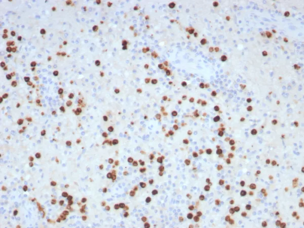 Formalin-fixed, paraffin-embedded human brain stained with GLUL Recombinant Rabbit Monoclonal Antibody (GLUL/8996R). HIER: Tris/EDTA, pH9.0, 45min. 2°C: HRP-polymer, 30min. DAB, 5min.