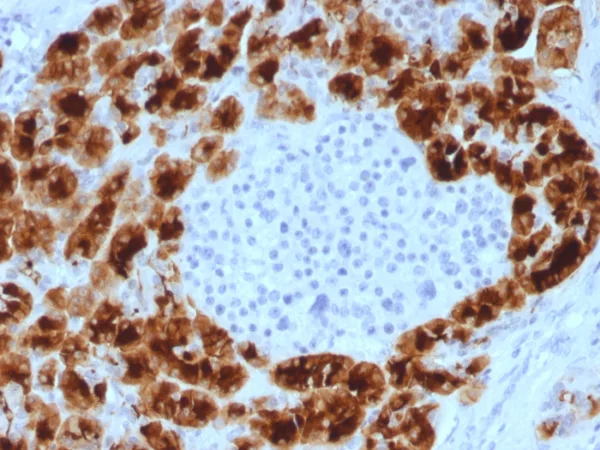 GP2 (Glycoprotein 2) / ZAP75 Antibody - Image 3