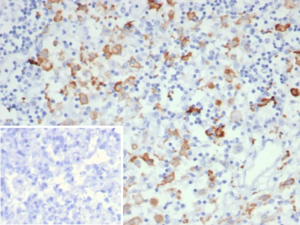 Formalin-fixed, paraffin-embedded human lymph node stained with CD163L1 Mouse Monoclonal Antibody (CD163L1/7971). Inset: PBS instead of primary antibody; secondary only negative control.