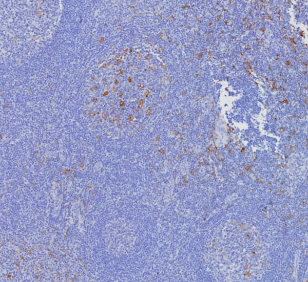 Formalin-fixed, paraffin-embedded human tonsil stained with CD163L1 Mouse Monoclonal Antibody (CD163L1/7972). HIER: Tris/EDTA, pH9.0, 45min. 2°C: HRP-polymer, 30min. DAB, 5min.