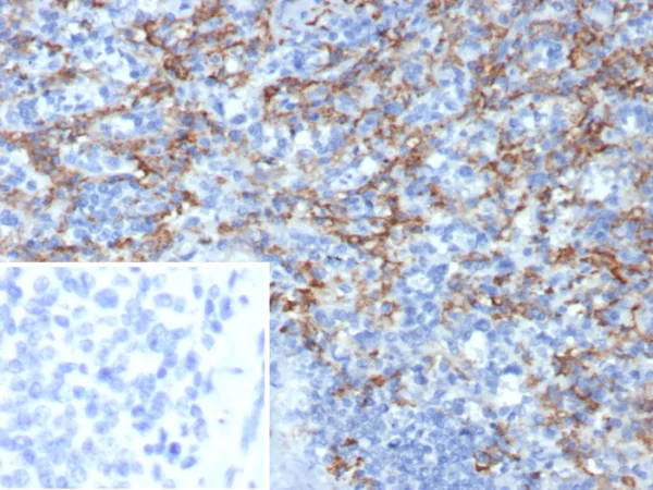 Formalin-fixed, paraffin-embedded human spleen stained with CD163L1 Mouse Monoclonal Antibody (CD163L1/7974). Inset: PBS instead of primary antibody; secondary only negative control.