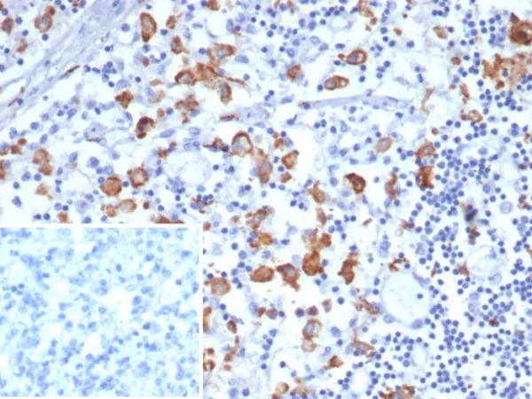 Formalin-fixed, paraffin-embedded human lymph node stained with CD163L1 Mouse Monoclonal Antibody (CD163L1/7974). Inset: PBS instead of primary antibody; secondary only negative control.