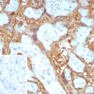 Formalin-fixed, paraffin-embedded human placenta stained with Galectin-13 / PP13 Monoclonal Antibody (PP13/8897). Inset: PBS instead of primary antibody; secondary only negative control.