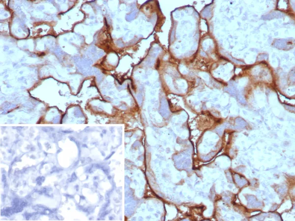 Formalin-fixed, paraffin-embedded human placenta stained with  PD-L1 Recombinant Rabbit Monoclonal Antibody (PDL1/8591R). Inset: PBS instead of primary antibody; secondary only negative control.