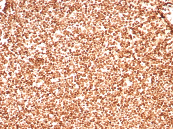 Formalin-fixed, paraffin-embedded human lymph node stained with Histone H1 Recombinant Mouse Monoclonal Antibody (rHH1/8702). HIER: Tris/EDTA, pH9.0, 45min. 2: HRP-polymer, 30min. DAB, 5min.