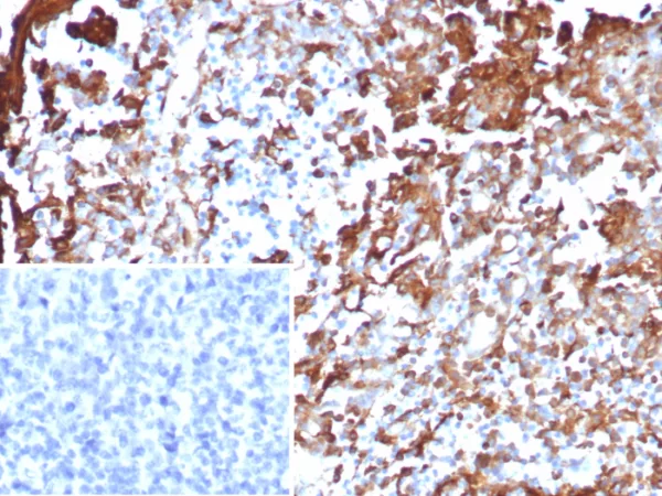 Annexin A1 Antibody in Immunohistochemistry (IHC (P))