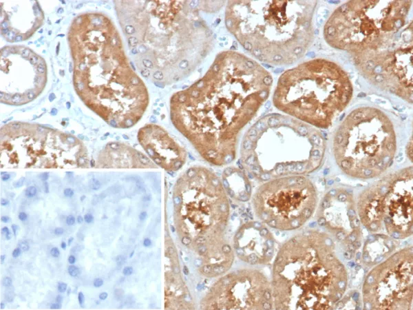 KCNIP2 / KCHIP2 Antibody