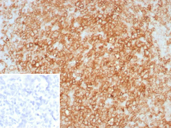 Formalin-fixed, paraffin-embedded human tonsil stained with HLA-DR Recombinant Mouse Monoclonal Antibody (rHLA-DRA/8285). Inset: PBS instead of primary antibody; secondary only negative control.