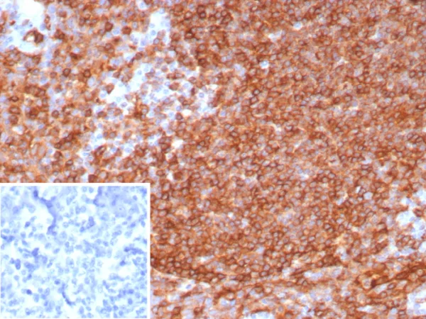 Formalin-fixed, paraffin-embedded human tonsil stained with HLA-DR Recombinant Rabbit Monoclonal Antibody (HLA-DRA/8287R). Inset: PBS instead of primary antibody; secondary only negative control