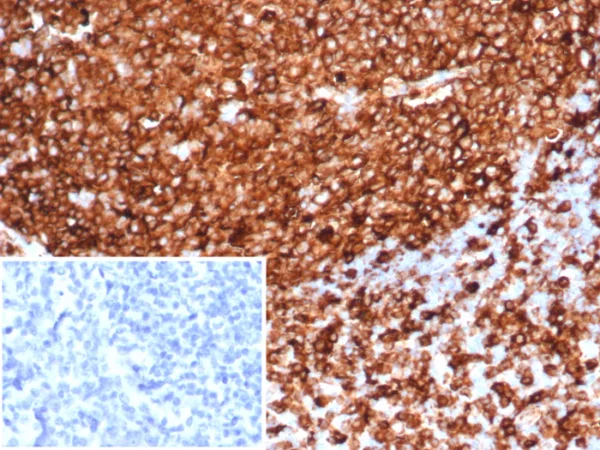 Formalin-fixed, paraffin-embedded human tonsil stained with HLA-DR Recombinant Rabbit Monoclonal Antibody (HLA-DRA/6839R). Inset: PBS instead of primary antibody; secondary only negative control.