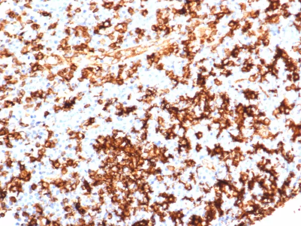 Formalin-fixed, paraffin-embedded human tonsil stained with HLA-DR Recombinant Rabbit Monoclonal Antibody (HLA-DRA/6839R). HIER: Tris/EDTA, pH9.0, 45min. 2°C: HRP-polymer, 30min. DAB, 5min.