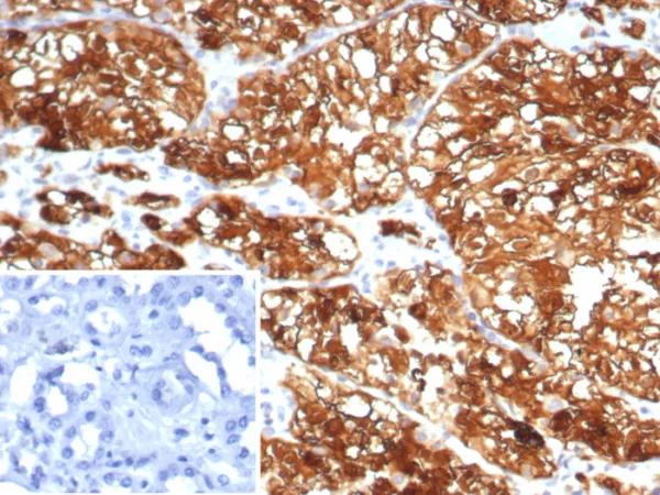 Formalin-fixed, paraffin-embedded human kidney stained with HLA-G Mouse Monoclonal Antibody (HLAG/7750). Inset: PBS instead of primary antibody; secondary only negative control.