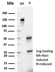 SDS-PAGE Analysis of Purified HLA-G Mouse Monoclonal Antibody (HLAG/7094). Confirmation of Purity and Integrity of Antibody.