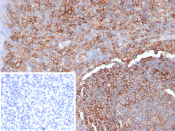 Formalin-fixed, paraffin-embedded human tonsil stained with HLA-G Mouse Monoclonal Antibody (HLAG/7094). Inset: PBS instead of primary antibody; secondary only negative control.