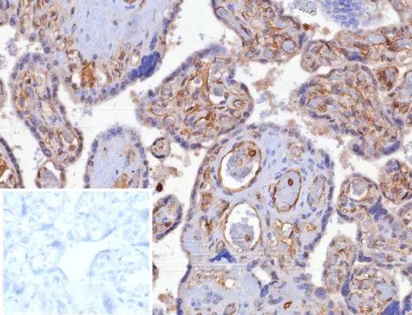 Formalin-fixed, paraffin-embedded human placenta stained with HLA-G Recombinant Rabbit Monoclonal Antibody (HLAG/8344R). Inset: PBS instead of primary antibody; secondary only negative control.