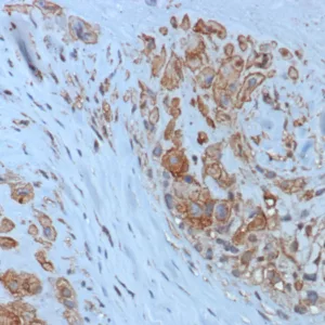 Recombinant HLA-G (Major Histocompatibility Complex, class I, G) Antibody