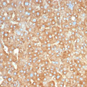 Formalin-fixed, paraffin-embedded human liver stained with Haptoglobin Mouse Monoclonal Antibody (HP/3831). HIER: Tris/EDTA, pH9.0, 45min. 2°C: HRP-polymer, 30min. DAB, 5min.