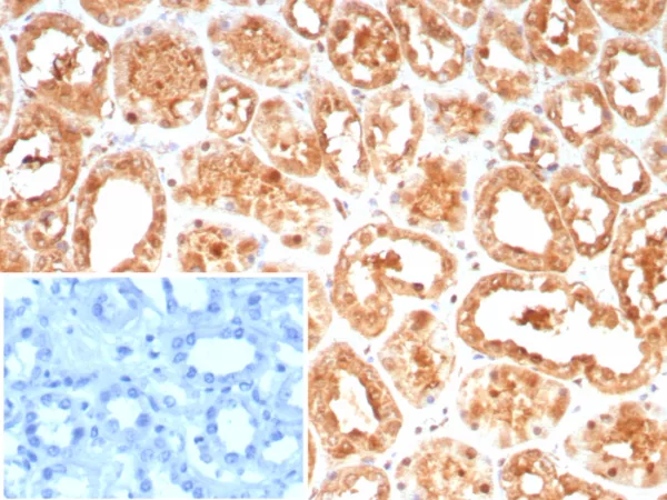 Formalin-fixed, paraffin-embedded human kidney stained with HSPA1A Mouse Monoclonal Antibody (HSPA1A/7936). Inset: PBS instead of primary antibody; secondary only negative control.