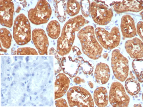 Formalin-fixed, paraffin-embedded human kidney stained with HSP60 Rabbit Recombinant Monoclonal Antibody (HSPD1/8406R). Inset: PBS instead of primary antibody; secondary only negative control.