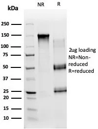 SDS-PAGE Analysis of Purified CD54 / ICAM-1 Mouse Monoclonal Antibody (ICAM1/6606). Confirmation of Purity and Integrity of Antibody.
