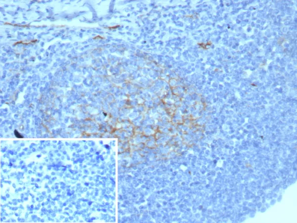 Formalin-fixed, paraffin-embedded human tonsil stained with CD54 / ICAM-1 Recombinant Rabbit Monoclonal Antibody (ICAM1/8677R). Inset: PBS instead of primary antibody; secondary only negative control.