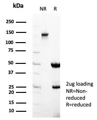 SDS-PAGE Analysis of Purified STING1 Mouse Monoclonal Antibody (STING1/7433). Confirmation of Purity and Integrity of Antibody.