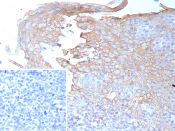 Formalin-fixed, paraffin-embedded human tonsil stained with Interferon gamma Mouse Monoclonal Antibody (IFNG/9012). Inset: PBS instead of primary antibody; secondary only negative control.