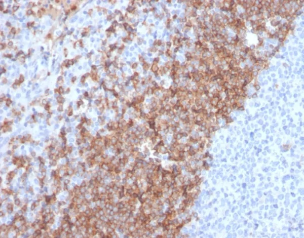 Formalin-fixed, paraffin-embedded human tonsil stained with IgD Recombinant Rabbit Monoclonal Antibody (IGHD/2730R). HIER: Tris/EDTA, pH9.0, 45min. 2°C: HRP-polymer, 30min. DAB, 5min.